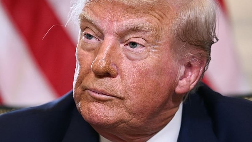 Trump's Hand Makeup Reappears on Overseas Trip to Scotland
