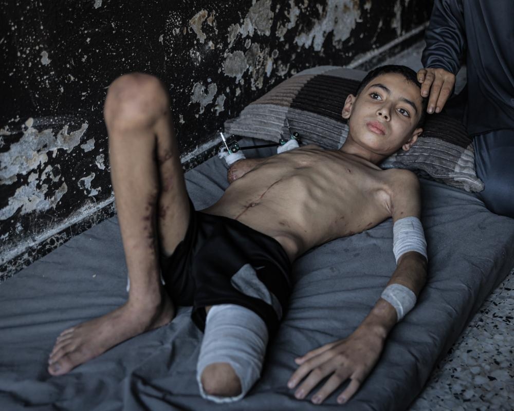 US state department stops issuing visas for Gaza's children to get medical care after far-right campaign