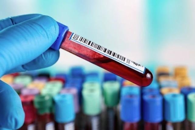 Blood test can help diagnose, track ALS patients, French study indicates