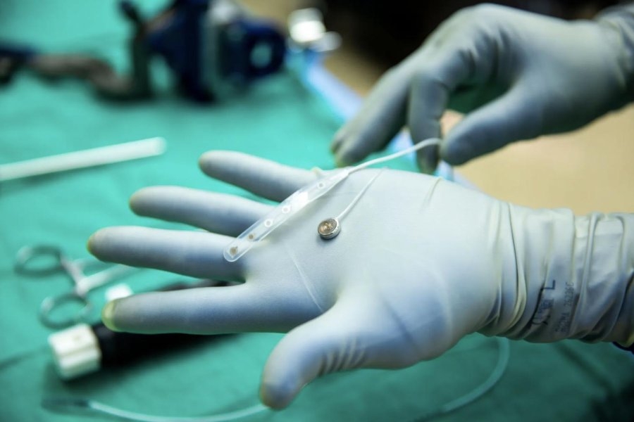 Paradromics implants brain-computer interface into first human patient