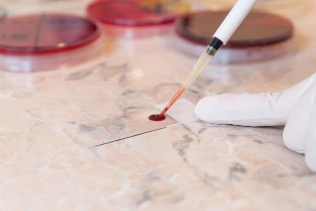 Blood testing could spot cancer early, study says