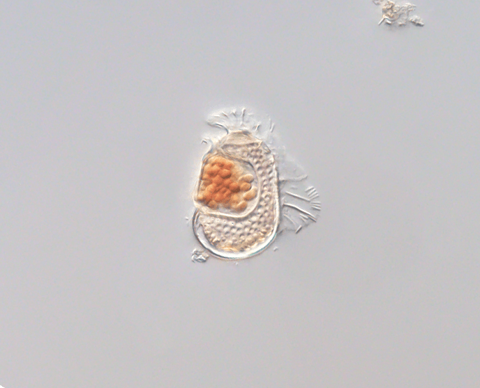 What is life? A little microbe raises big questions.