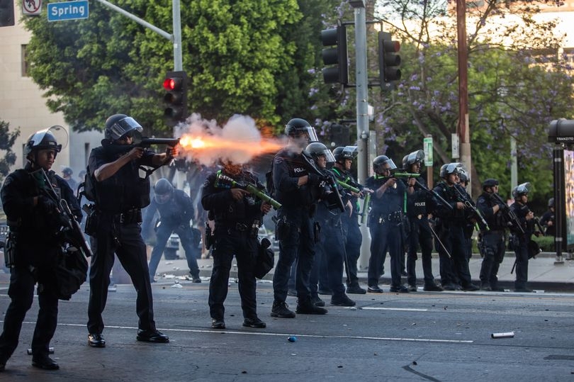 UK man has emergency surgery after being 'shot' in LA protests