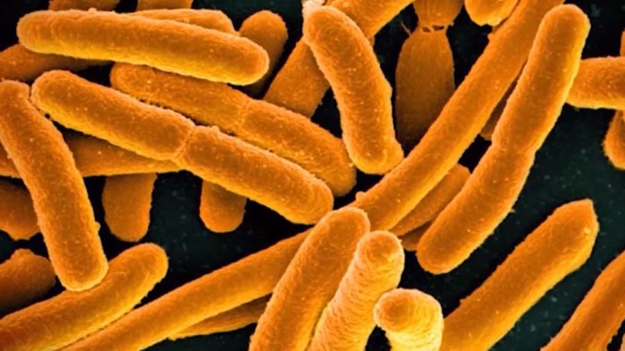 Boil water notice issued after E. Coli found in Samples Road area of Louisville