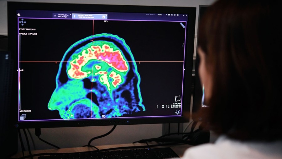 2 Your Health: Neurologist debunks brain health myths