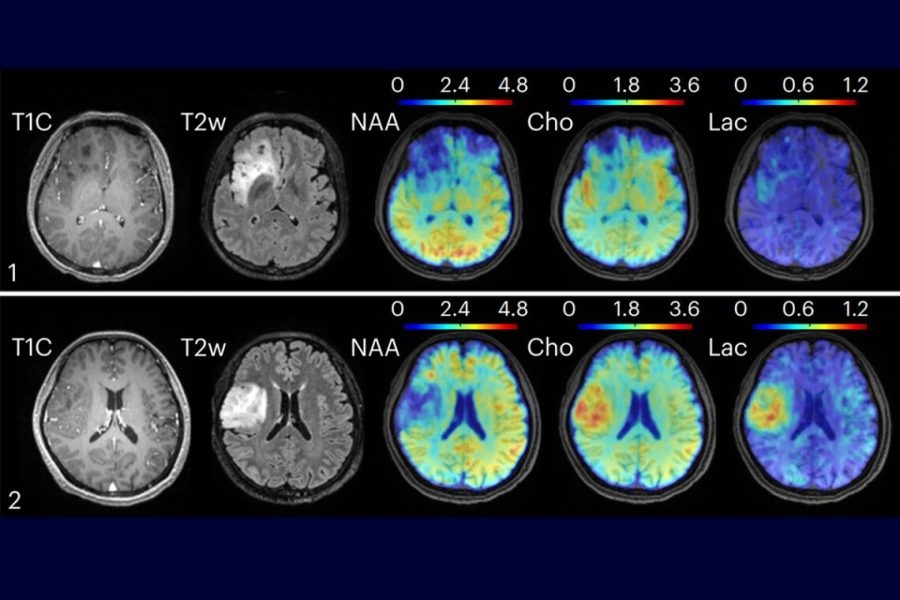 U of I researchers using new tech to map the brain, find diseases early-on