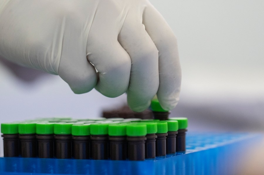 Shuttered central Ohio biotech firm faces lawsuit from former employees over layoffs