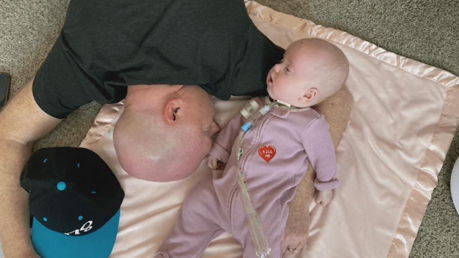 Metro family embraces life with baby battling rare, fatal genetic disorder