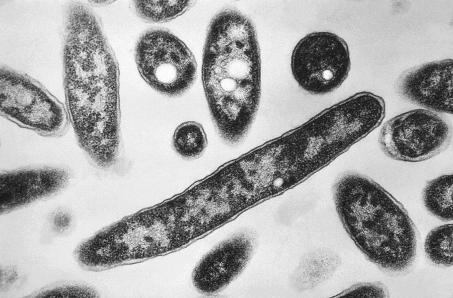 Legionnaire's disease reported in Miami Valley resident: What to know