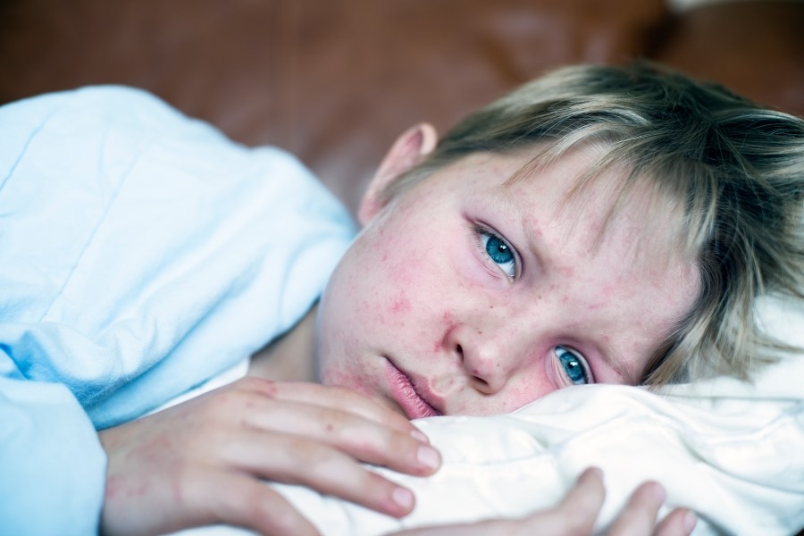 Confirmed case of measles at Prince George's County Montessori school