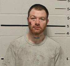 Enfield man allegedly bites police officer, tries to crush eyes