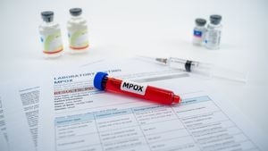 New Hampshire Department of Health identifies Merrimack County resident with monkeypox