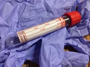 ‘Deceitful': 3 former execs at Mass.-based Magellan Diagnostics plead guilty over faulty lead tests