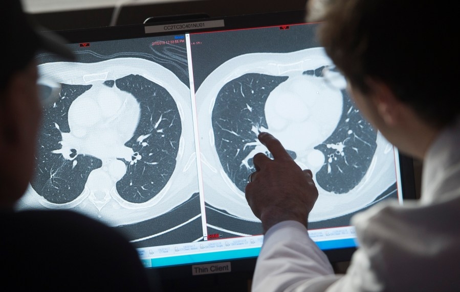 How immunotherapy can help battle cancer