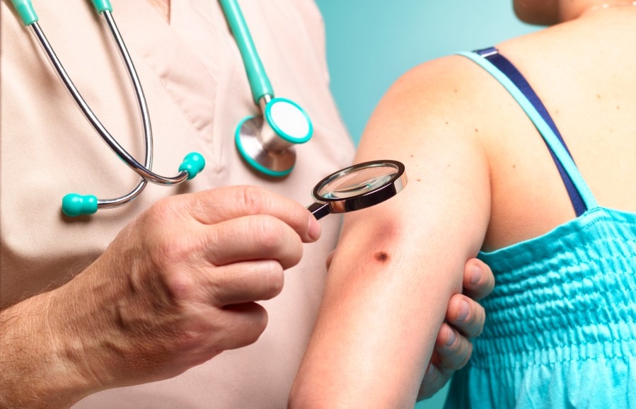 The first Monday in May is known as ‘Melanoma Monday'
