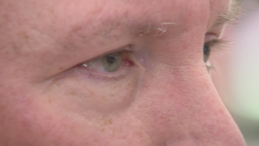 Non-profit fears for future of blindness research if Donald Trump's budget passes