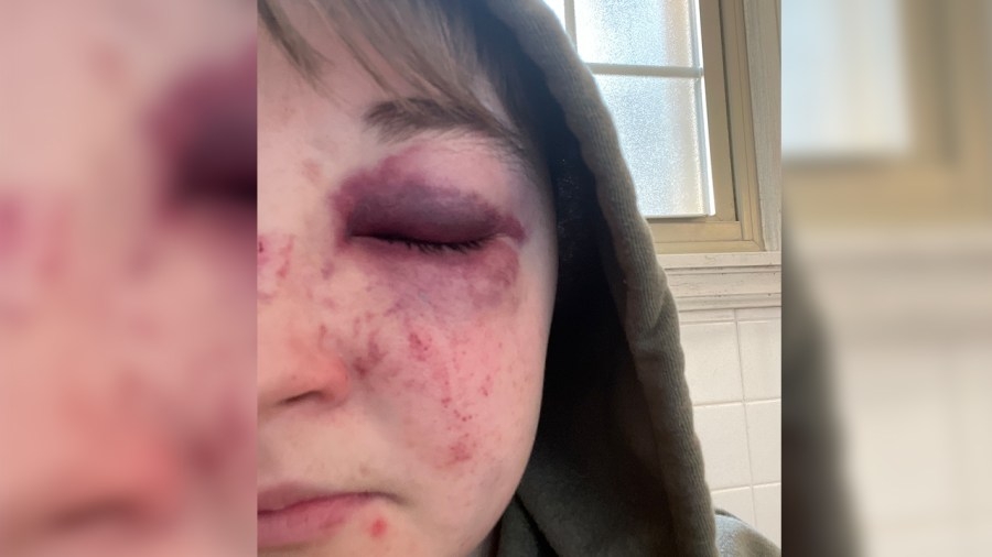 Man, teen accused of beating woman at suburban McDonald's over sexual orientation