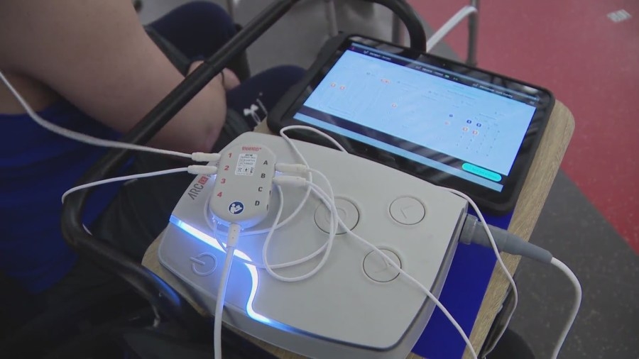 Non-invasive stimulation device shows promise in treating spinal cord injuries