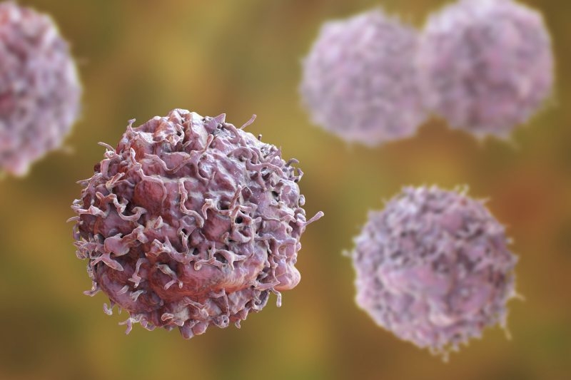 Genetic testing IDs some at higher risk for colorectal cancer