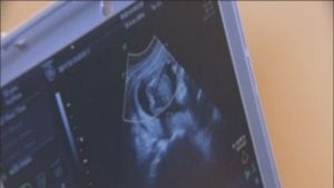 Florida lawmakers file legislation to repeal current state abortion law