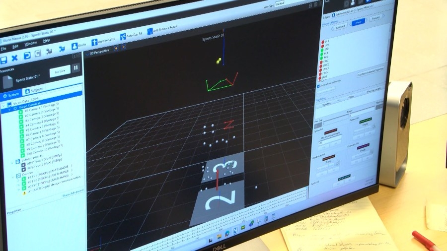 New Shriners tech will help young athletes safely return to sports following injuries