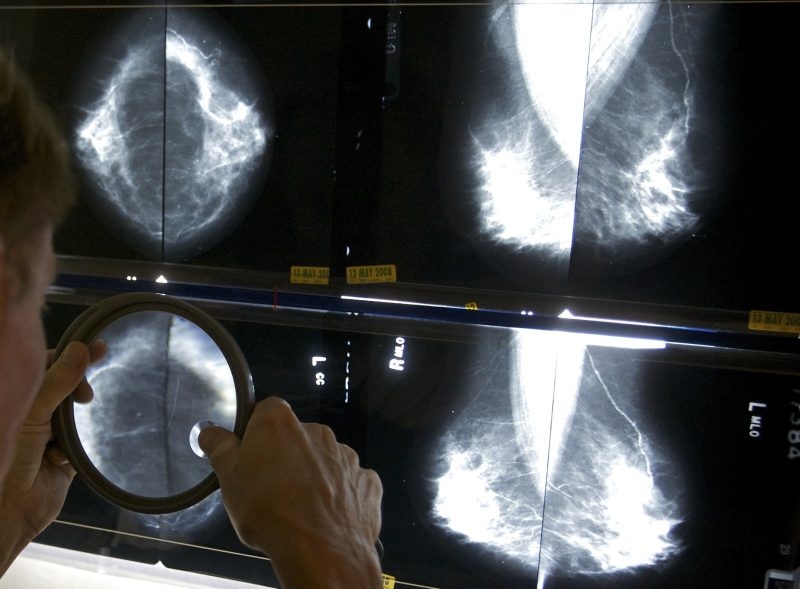 Live Well Mississippi event offers free cancer screenings