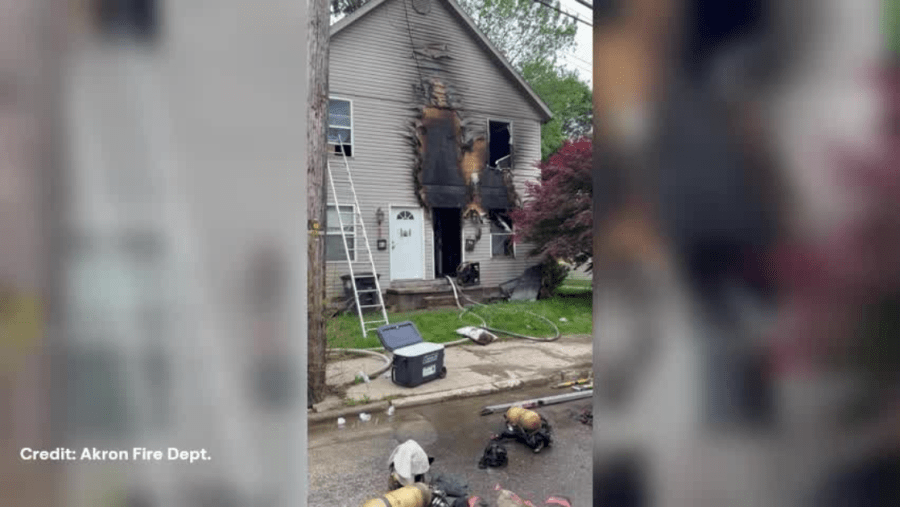 Woman badly burned in Akron fire