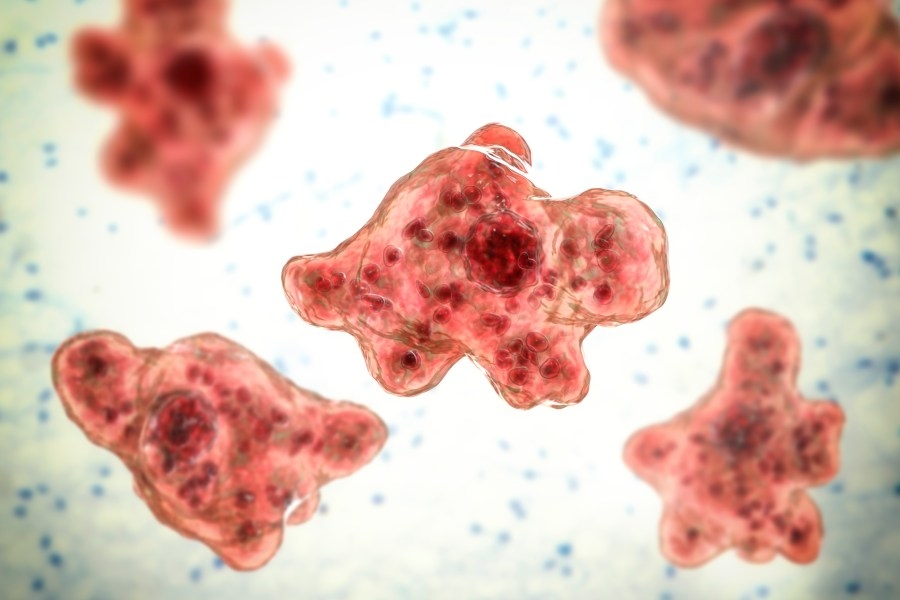 Woman dies from brain-eating amoeba after using tap water to clear sinuses: CDC