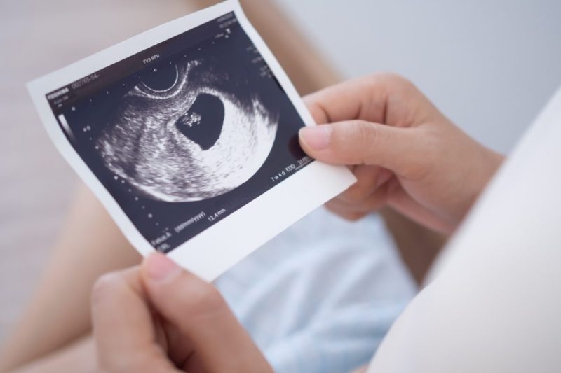 Missouri bill proposes registry for pregnant mothers to ‘reduce preventable abortions'