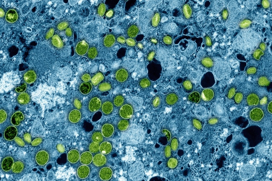 Mpox found in North Carolina wastewater, Health Dept. says