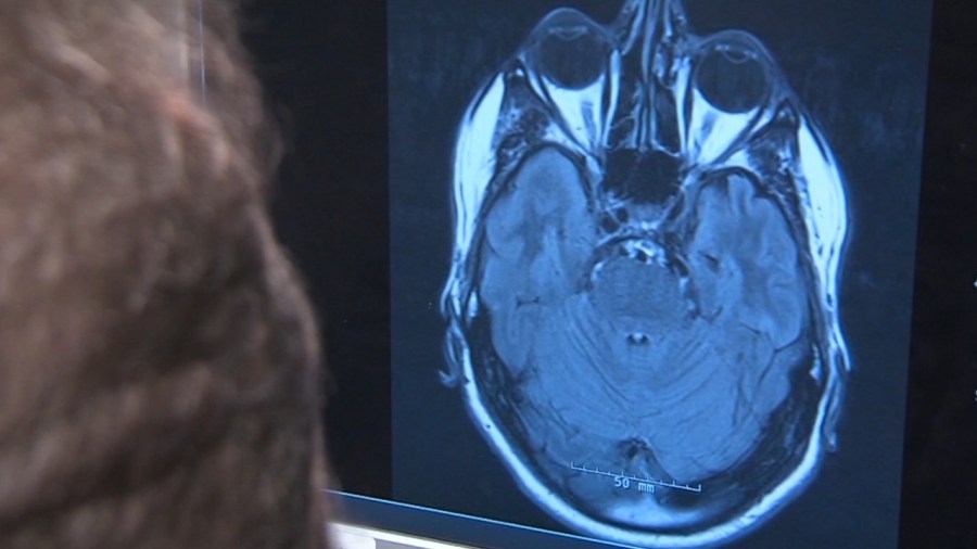 March is Brain Injury Awareness Month, are survivors in Ohio getting enough support?