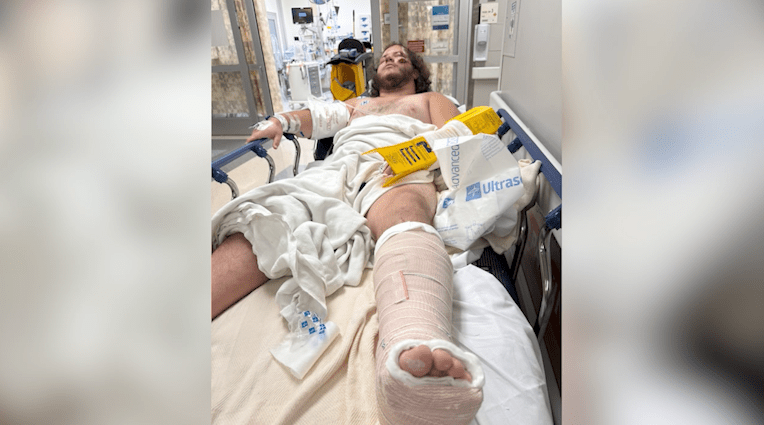 ‘Somebody knows where he is': Search continues for suspect in Nashville hit-and-run that left tourist seriously injured