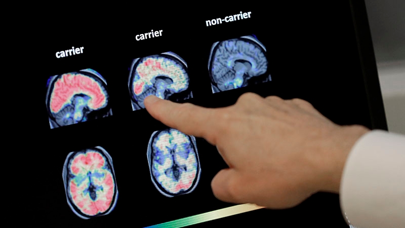 Eastern N.C. Alzheimer's Association hosts events for Brain Awareness Month