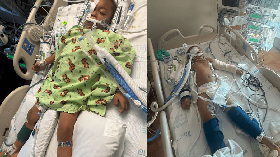 3-year-old, two adults injured in AR shooting