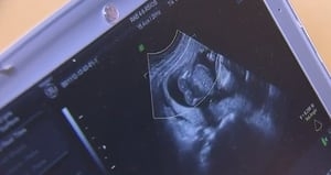 GA Supreme Court orders new look at whether abortion challenge lawsuit can proceed