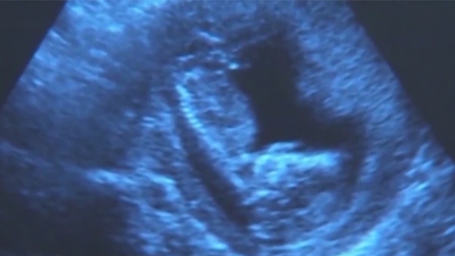 State Supreme Court rules in latest abortion ban lawsuit
