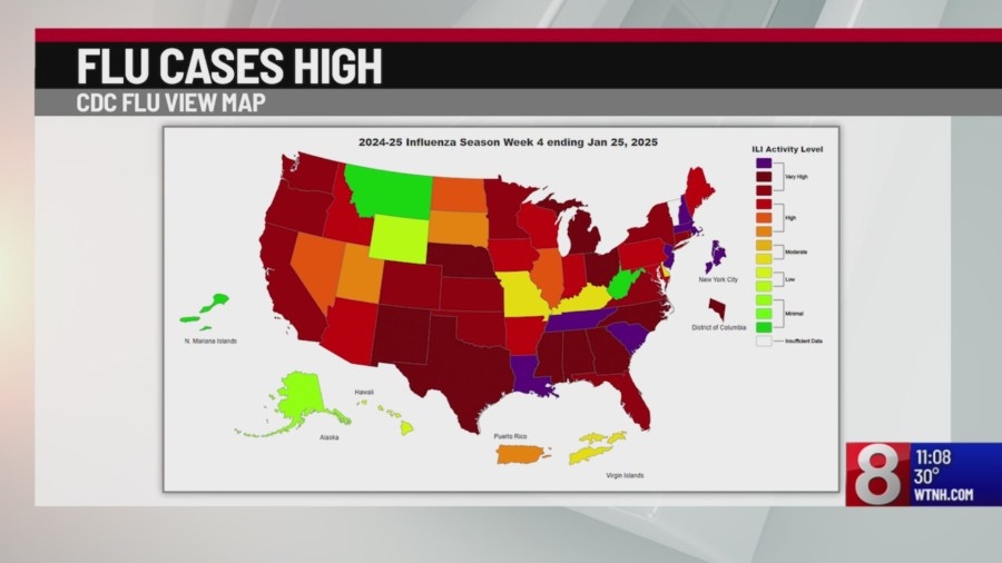 Flu cases spiking in Connecticut