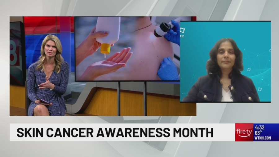Watch: Best skin cancer prevention tips