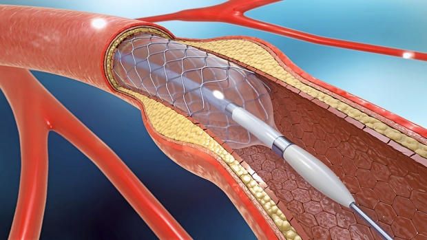 3 Medical Instruments Stocks Winning Big With GenAI Amid Global Gloom