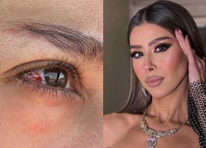 «مش بشوف كويس».. تدهور الحالة الصحية لـ إيناس عز الدين بسبب خطأ طبي (تفاصيل)