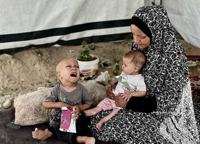 المجاعة تواصل الفتك بسكان غزة.. استشهاد طفلين أحدهما رضيع نتيجة سوء التغذية