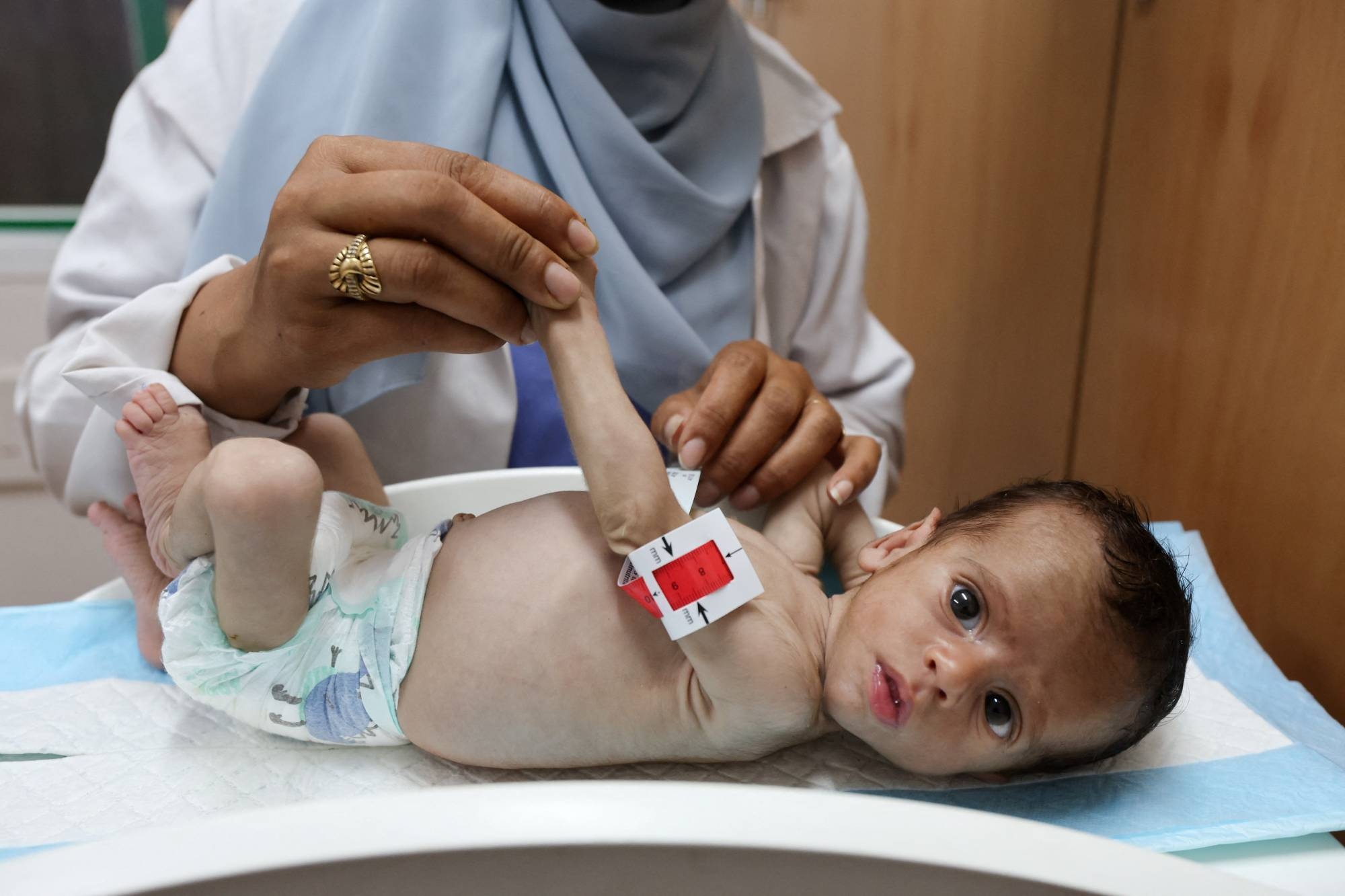 الأطفال في مواجهة الموت.. المجاعة تضرب غزة وتهدد حياة الآلاف