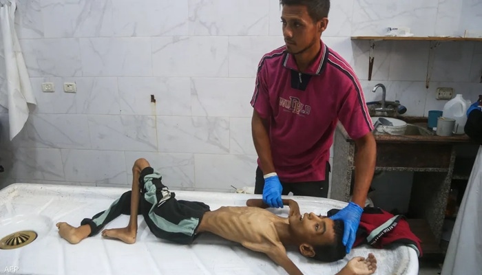 متلازمة 'غيلان باريه' تصيب أطفال غزة.. أرقام الوفيات ترتفع وسط ظروف صحية صعبة