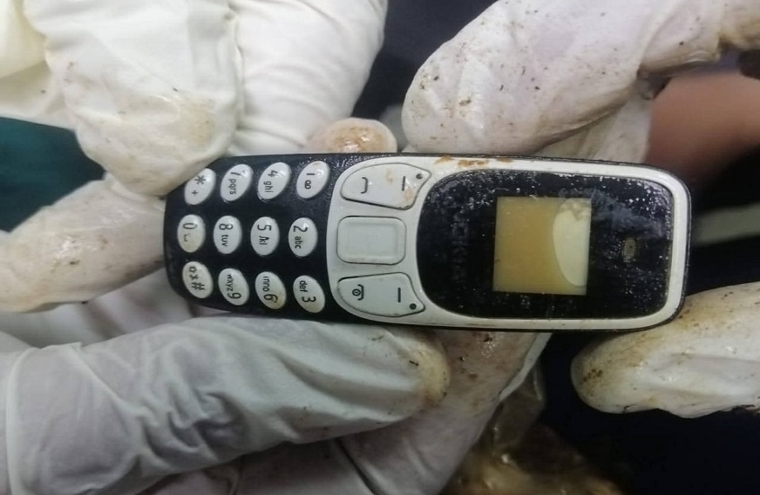في واقعة نادرة.. استخراج هاتف محمول من بطن شاب مصري بعد عامين من ابتلاعه