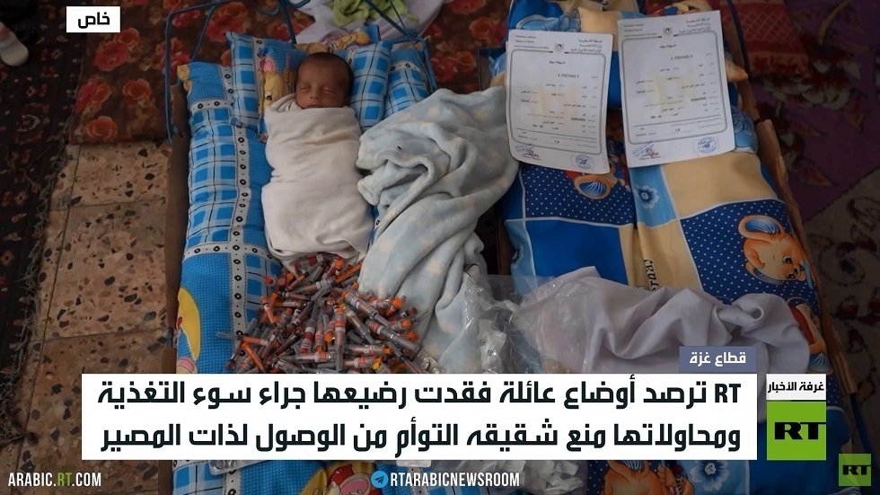 سوء التغذية يضرب أطفال قطاع غزة