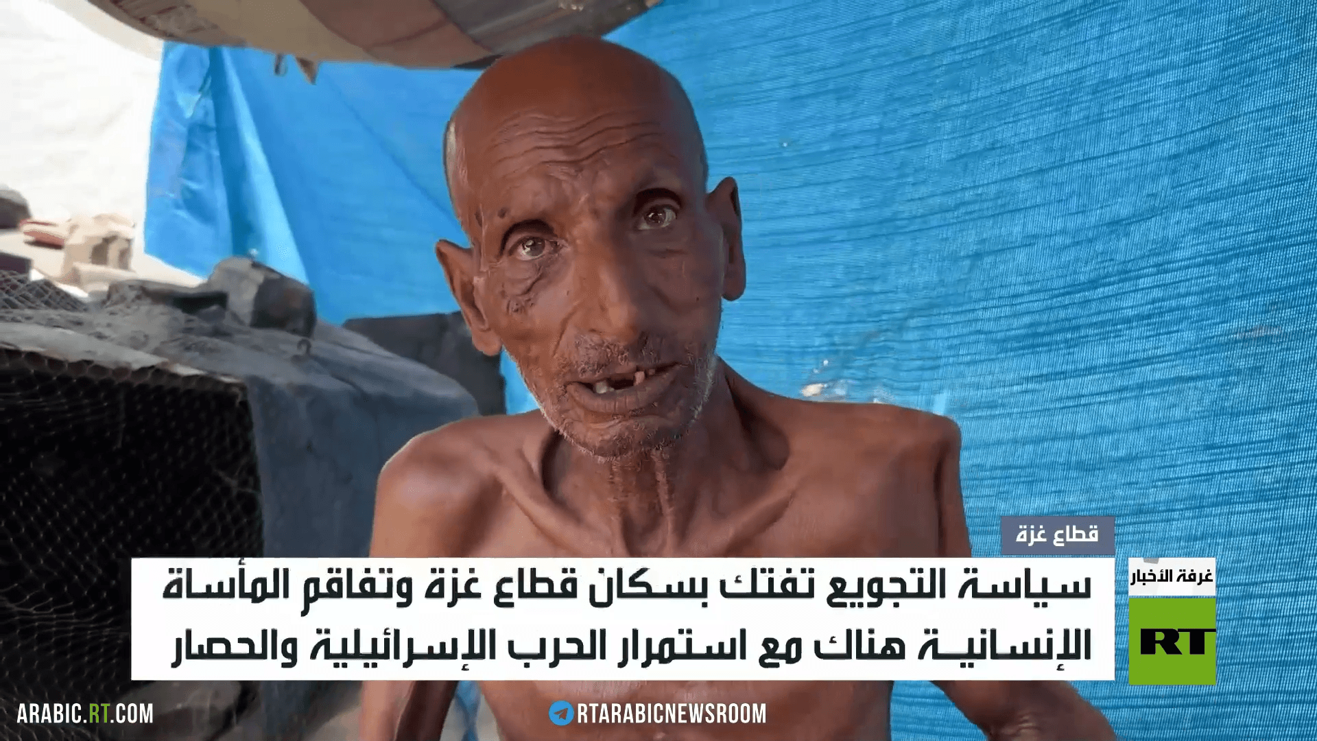 مأساة التجويع تفتك بسكان غزة