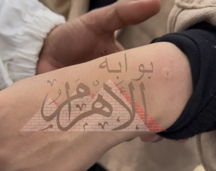 سم النحل.. علاج سحري أم إعلانات مُضللة؟.. اكتشف الحقيقة العلمية