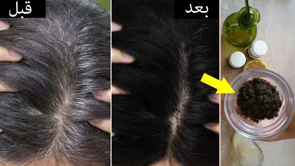 التخلص من الشعر الأبيض.. طريقة سحرية تعيد شباب شعرك