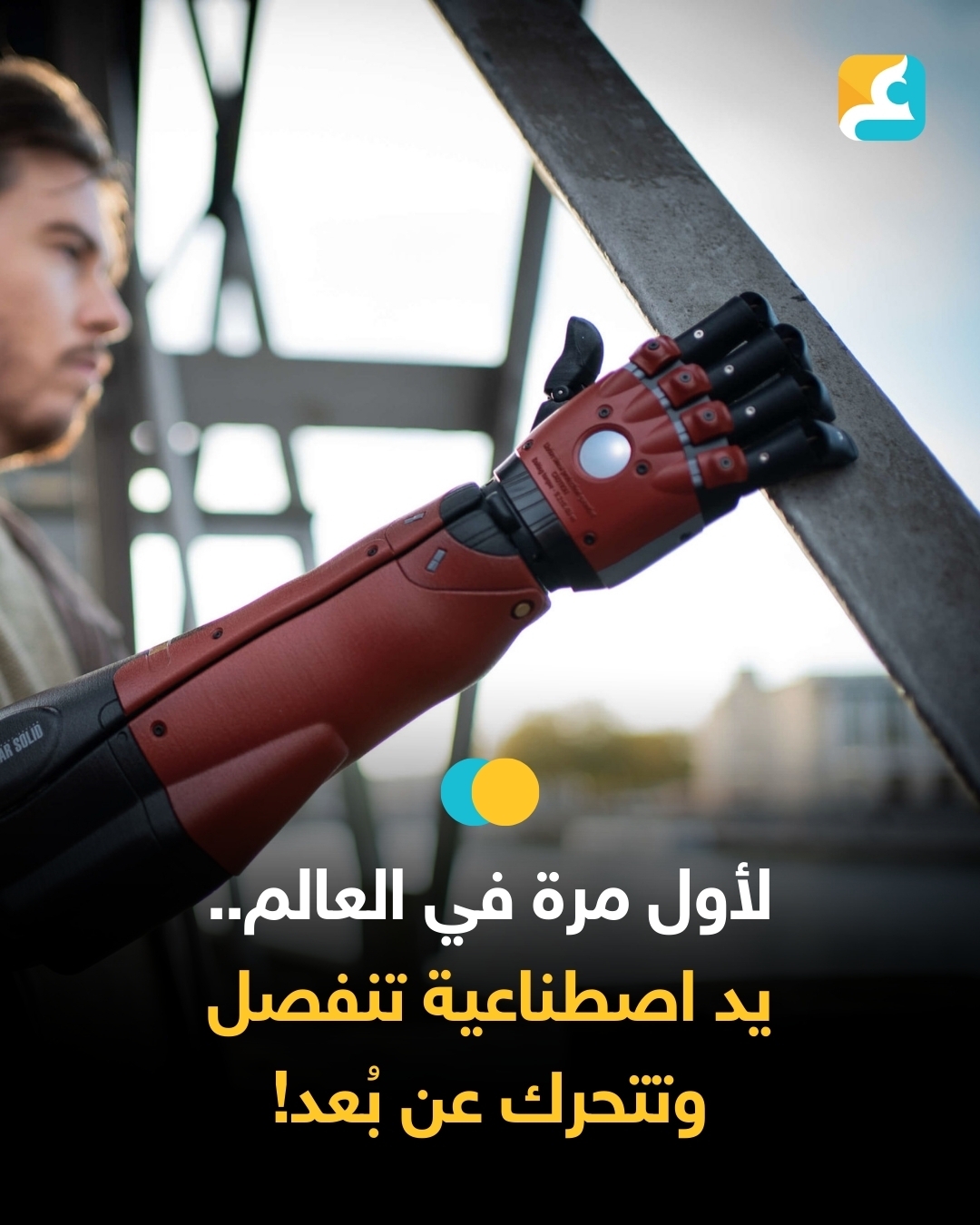 طورت شركة Open Bionics البريطانية ذراعًا اصطناعيًا جديدًا يدعى Hero، يتميز بإمكانية فصل اليد الآلية مع الاحتفاظ بالقدرة على التحكم بها عن بُعد
