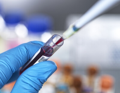 Labcorp Launches Molecular Residual Disease and Liquid Biopsy Solutions